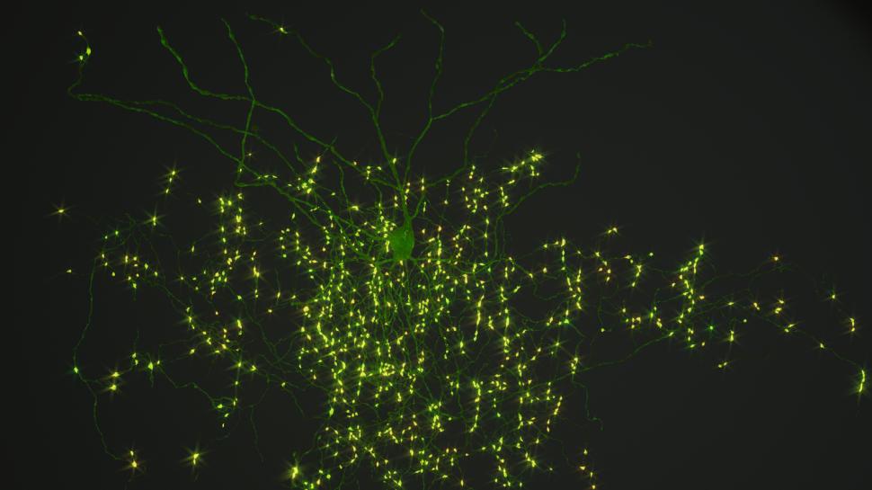 Progres major în neuroștiință, considerat cândva imposibil: Prima hartă exactă 3D a creierului. Cum arată 5,4 km de „cabluri” neuronale 965248