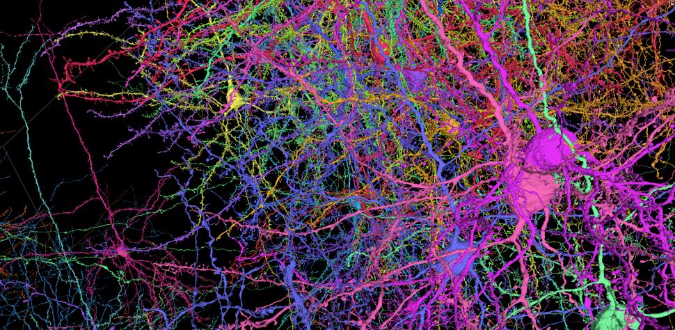 Progres major în neuroștiință, considerat cândva imposibil: Prima hartă exactă 3D a creierului. Cum arată 5,4 km de „cabluri” neuronale 965250