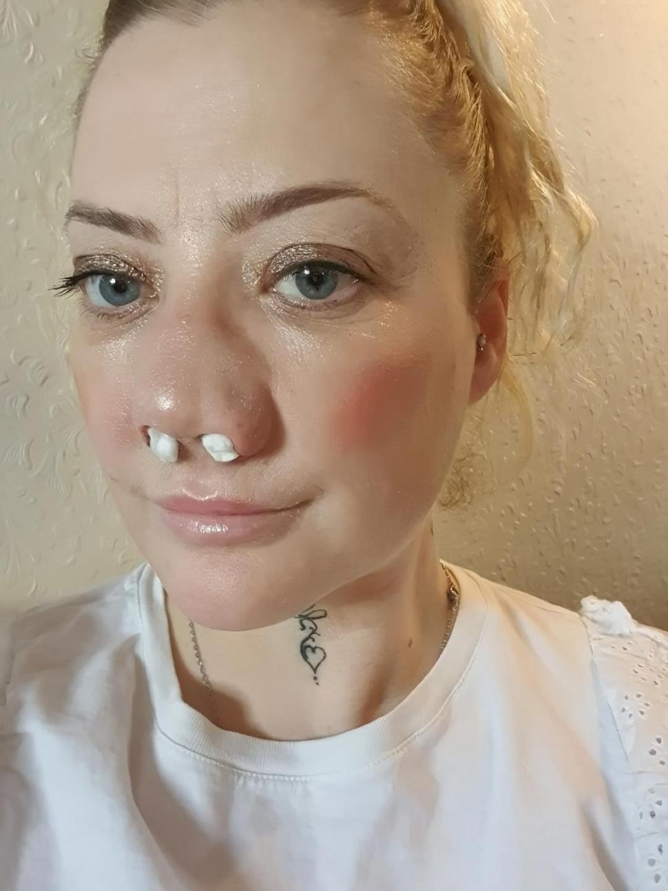 O femeie s-a dus în Turcia să-și facă dantura pe bani puțini. A fost desfigurată și suferă de dureri imposibile 977974