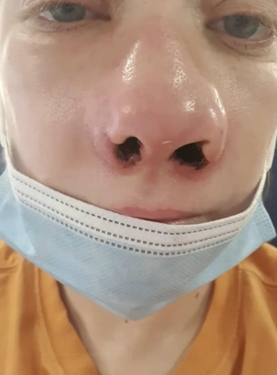 O femeie s-a dus în Turcia să-și facă dantura pe bani puțini. A fost desfigurată și suferă de dureri imposibile 977982