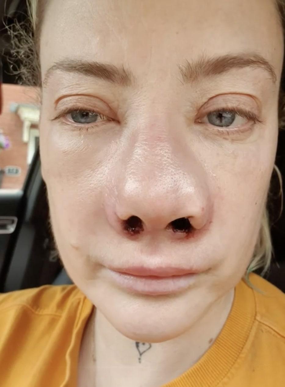 O femeie s-a dus în Turcia să-și facă dantura pe bani puțini. A fost desfigurată și suferă de dureri imposibile 977983