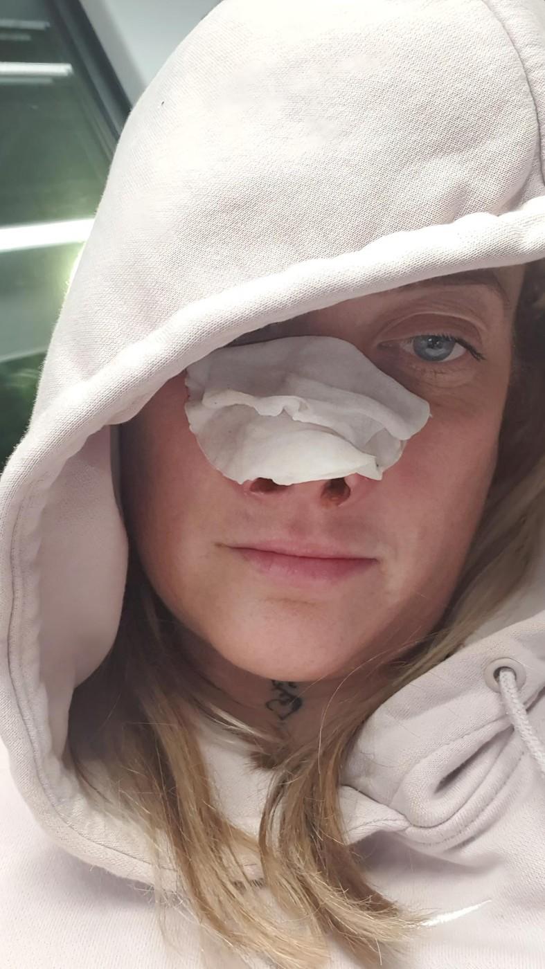 O femeie s-a dus în Turcia să-și facă dantura pe bani puțini. A fost desfigurată și suferă de dureri imposibile 977985