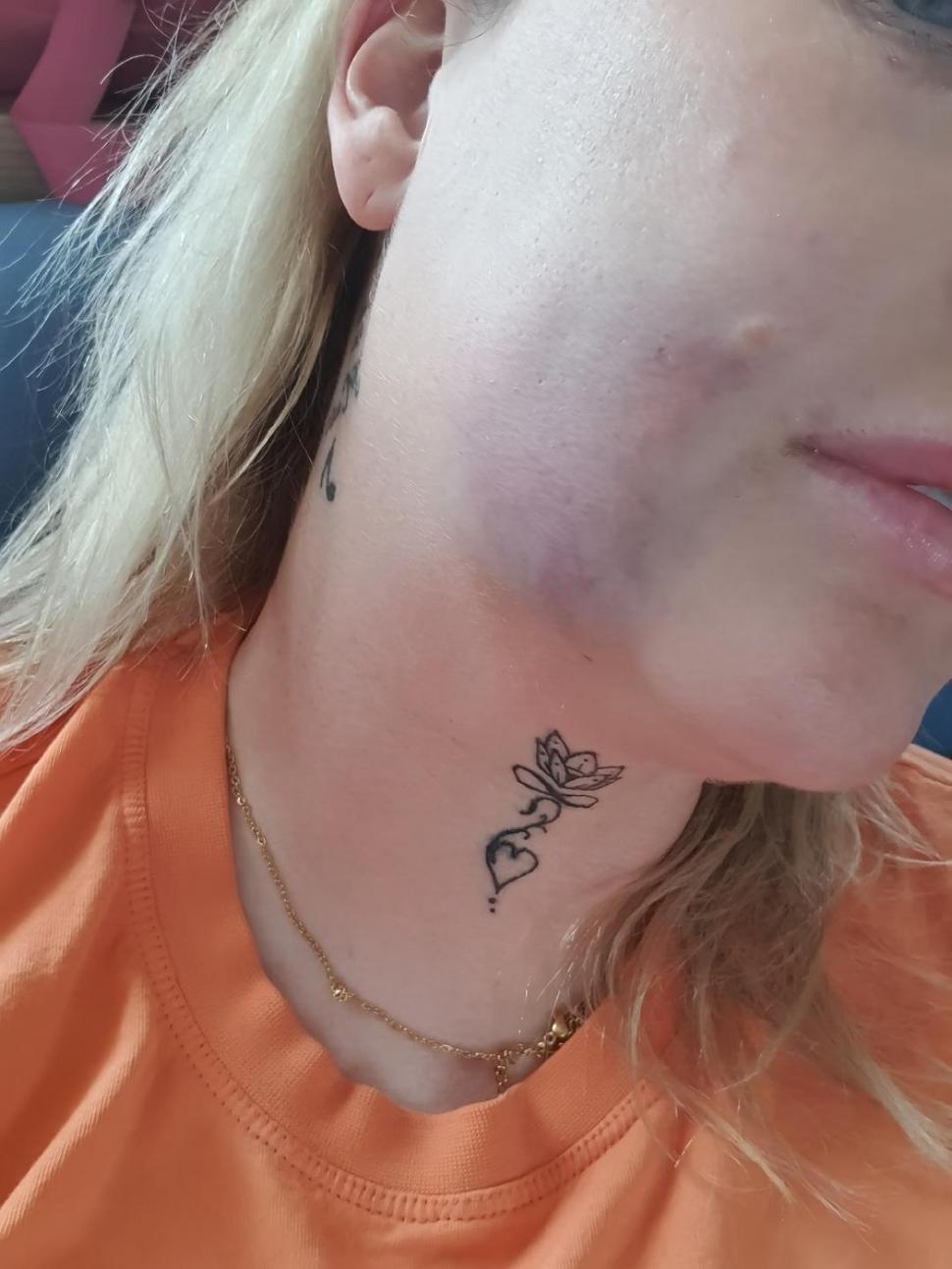 O femeie s-a dus în Turcia să-și facă dantura pe bani puțini. A fost desfigurată și suferă de dureri imposibile 977987