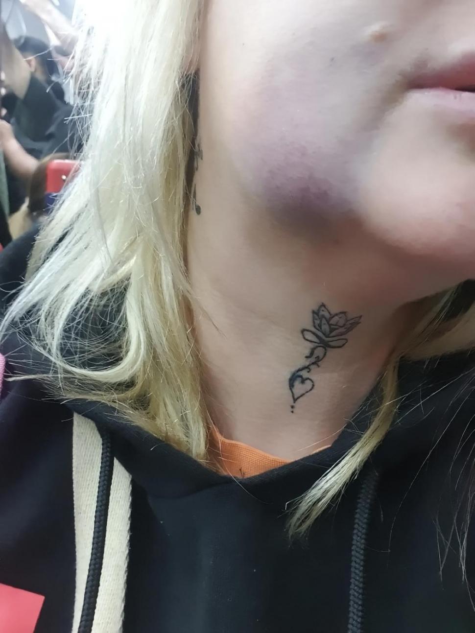 O femeie s-a dus în Turcia să-și facă dantura pe bani puțini. A fost desfigurată și suferă de dureri imposibile 977988