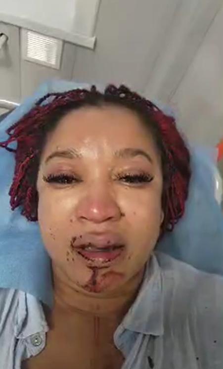 O femeie de culoare care s-a mutat din SUA în Rusia ca să scape de „discriminare” a fost bătută de noii ei vecini rasiști 990471