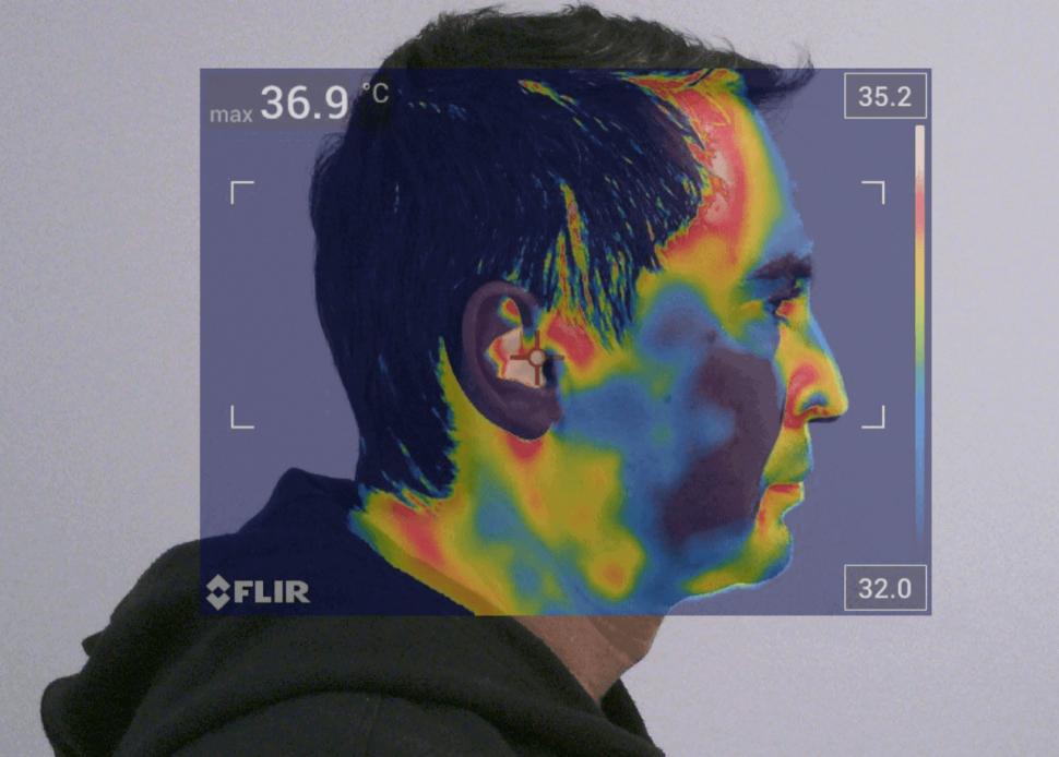 Ce legătură are maxilarul cu postura, oboseala cronică, durerile de cap, gât, urechi sau amețelile? Semnele unei disfuncții ATM (P) 991834