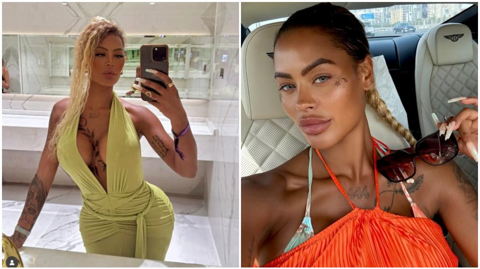 O femeie a povestit cum i-au căzut implanturile la fesieri la sala de sport și cât a cheltuit pentru intervenții de corecție 992760