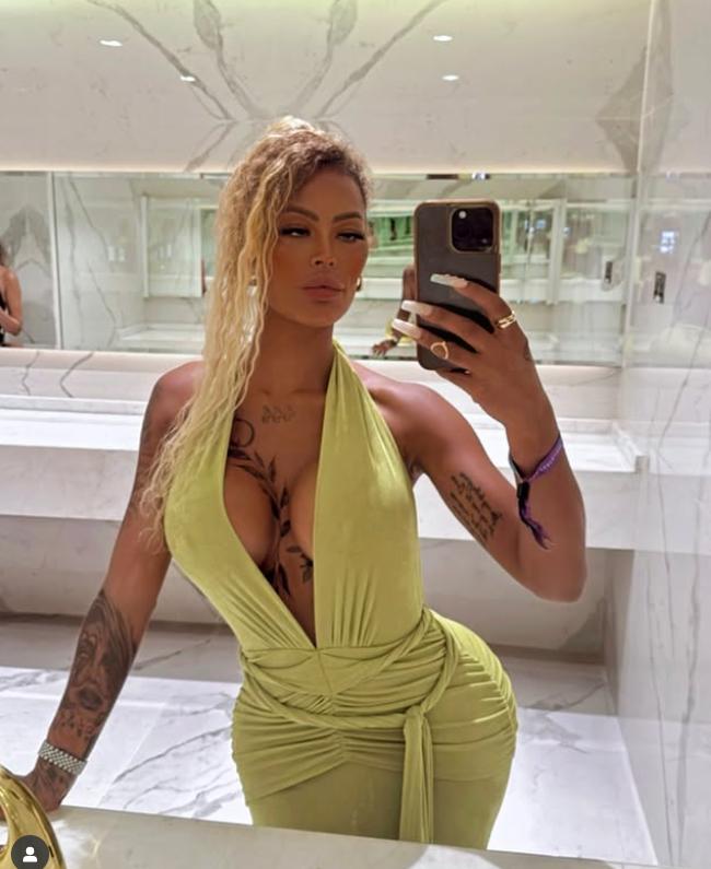 O femeie a povestit cum i-au căzut implanturile la fesieri la sala de sport și cât a cheltuit pentru intervenții de corecție 992767