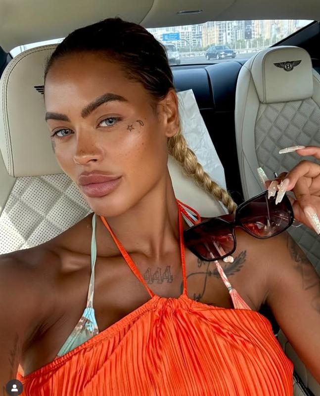 O femeie a povestit cum i-au căzut implanturile la fesieri la sala de sport și cât a cheltuit pentru intervenții de corecție 992768