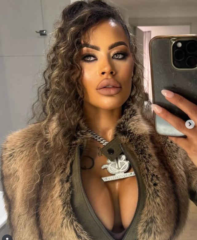 O femeie a povestit cum i-au căzut implanturile la fesieri la sala de sport și cât a cheltuit pentru intervenții de corecție 992777