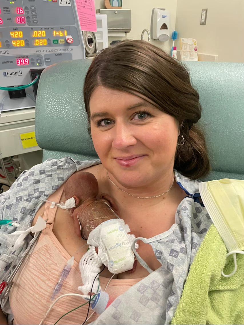 Povestea emoţionantă a celui mai prematur bebeluş din lume. S-a născut la doar 21 de săptămâni, în Iowa 992959