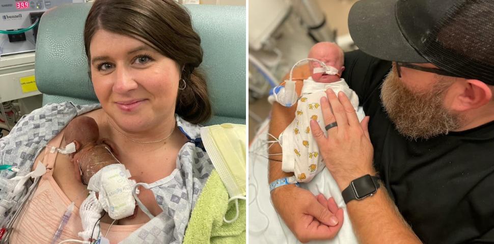 Povestea emoţionantă a celui mai prematur bebeluş din lume. S-a născut la doar 21 de săptămâni, în Iowa 992960