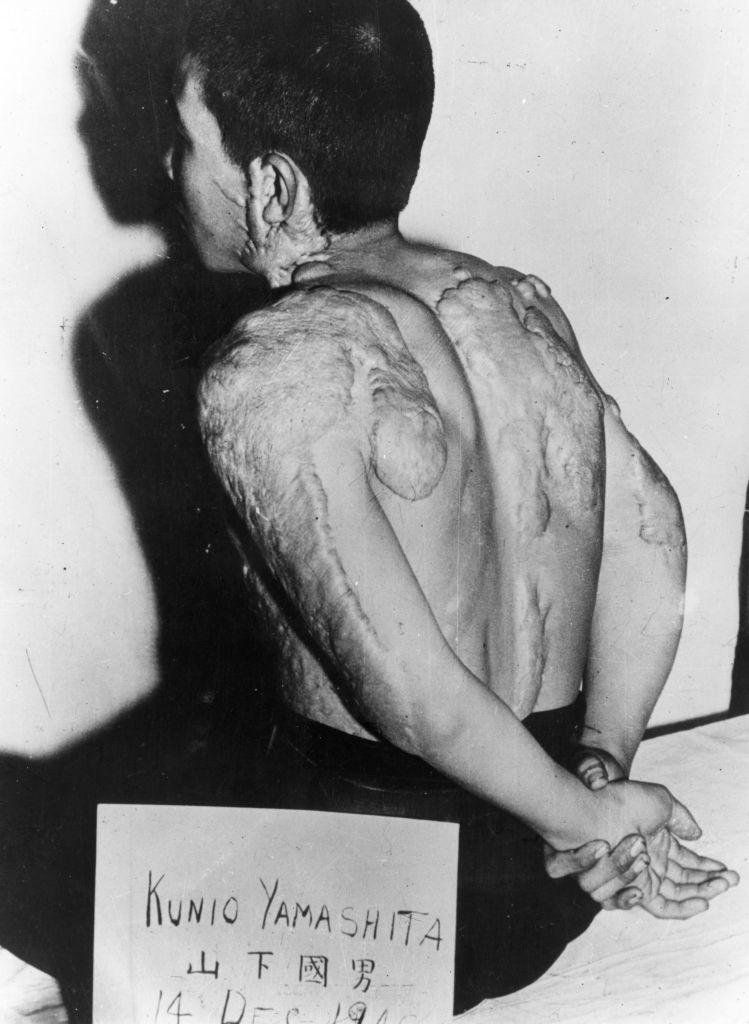 Hiroshima, 6 august 1945: Imagini de groază din arhive arată dezastrul produs acum 80 de ani de bomba atomică, după explozie 996185