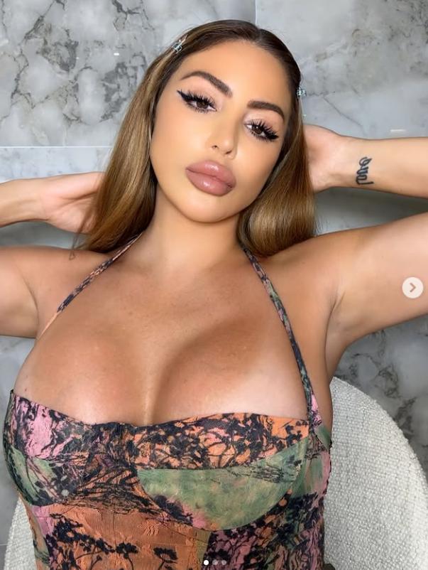 Ultima ei apariție a șocat. Acum, vedeta explică de ce fața ei arată așa acum 997772