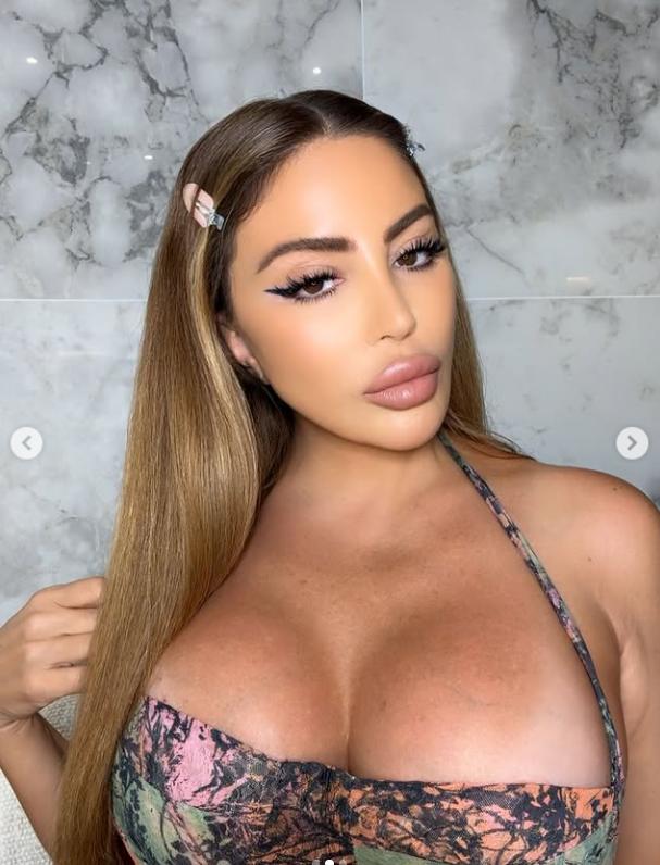 Ultima ei apariție a șocat. Acum, vedeta explică de ce fața ei arată așa acum 997773