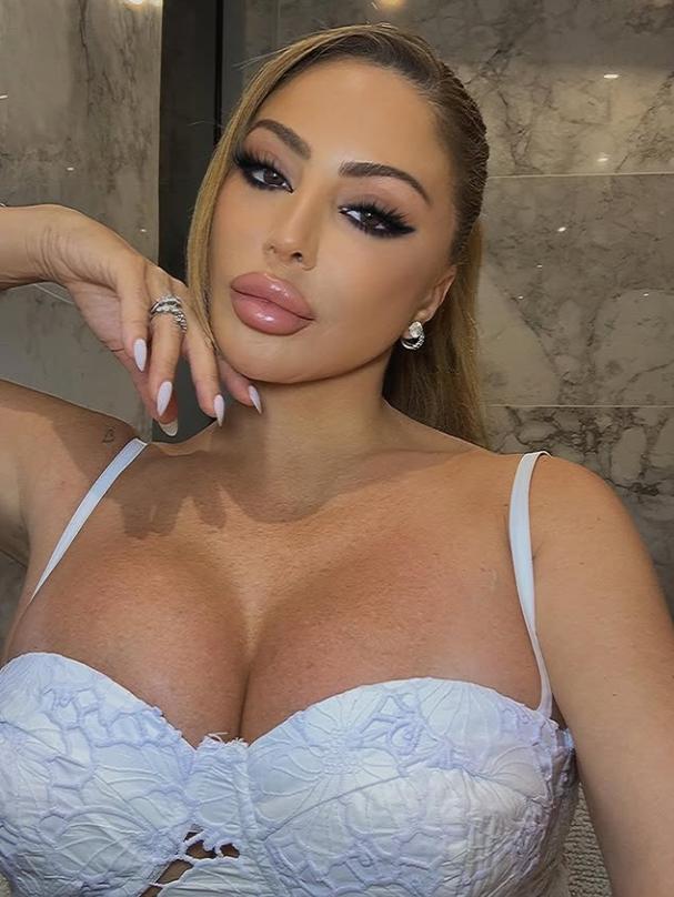 Ultima ei apariție a șocat. Acum, vedeta explică de ce fața ei arată așa acum 997777