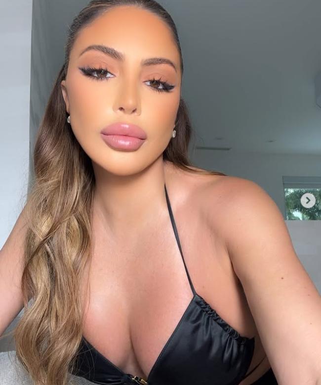 Ultima ei apariție a șocat. Acum, vedeta explică de ce fața ei arată așa acum 997781