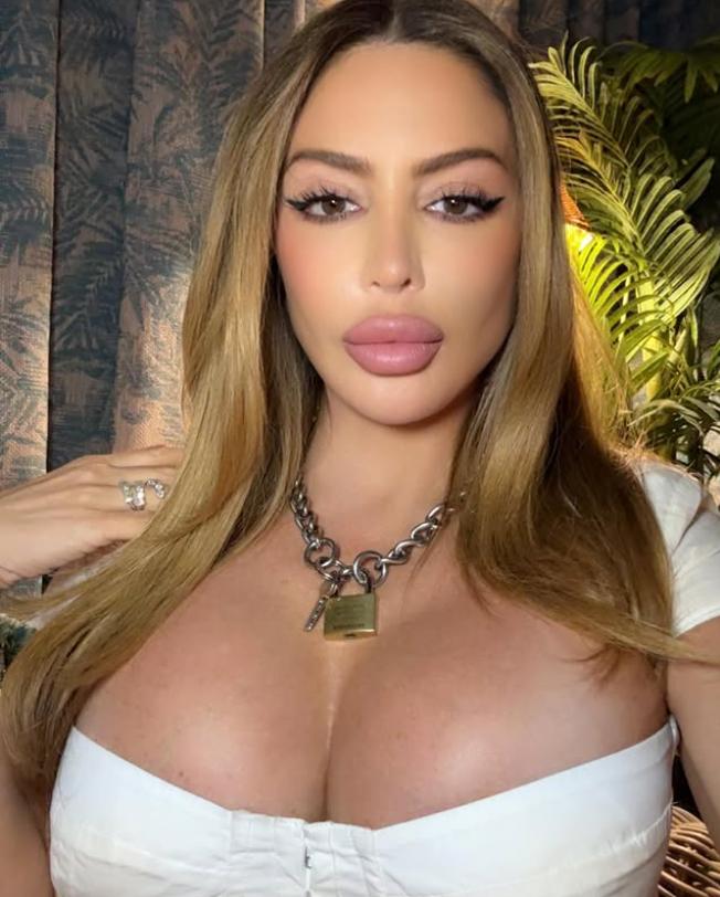 Ultima ei apariție a șocat. Acum, vedeta explică de ce fața ei arată așa acum 997782