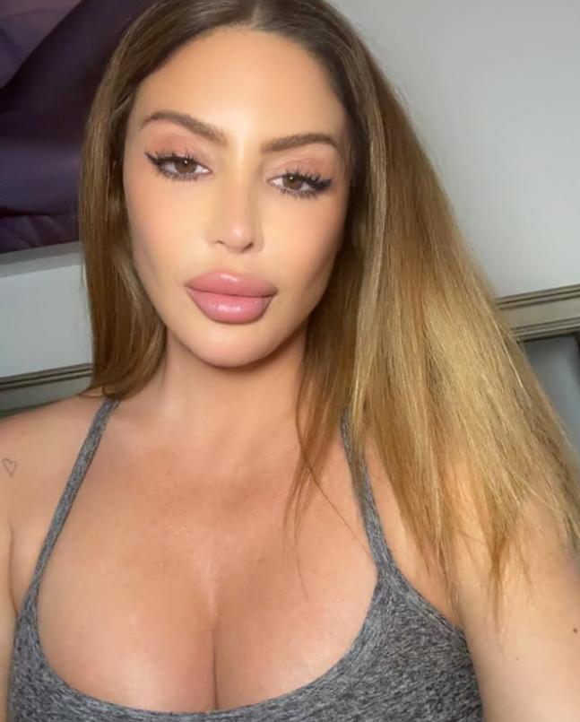 Ultima ei apariție a șocat. Acum, vedeta explică de ce fața ei arată așa acum 997784