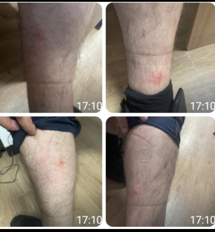 Mai mulţi agenţi au fost muşcaţi de ploşniţe în sediile Poliţiei Capitalei. 10 persoane au ajuns la spital 1004205