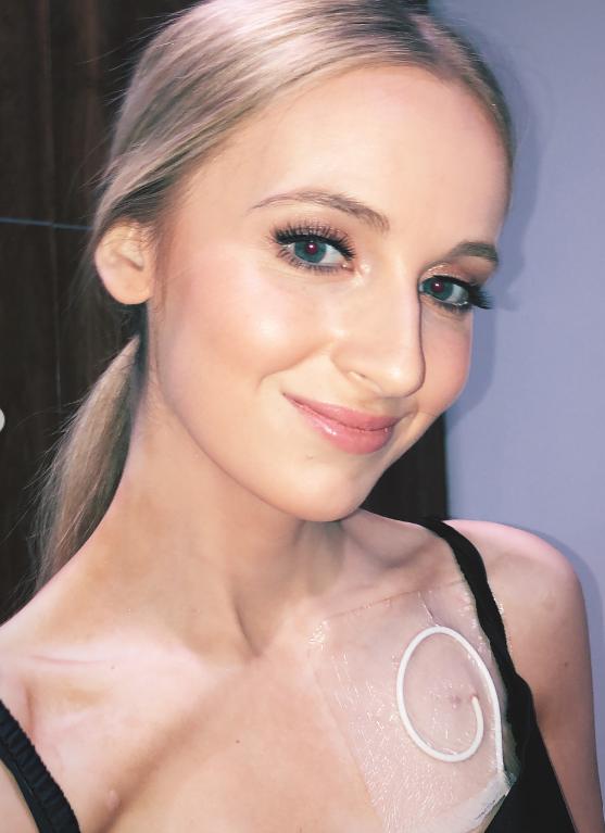 „Vă rog, lăsați-mă să plec”. O tânără de 25 de ani cu o boală rară aflată în fază terminală a decis să moară „în propriile condiții” 1024893