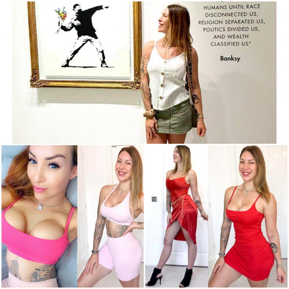 Implantul de păr, noua tendință în rândul femeilor. Rata lor de succes e complicată, dar o culturistă a ales să facă intervenţia 1029599