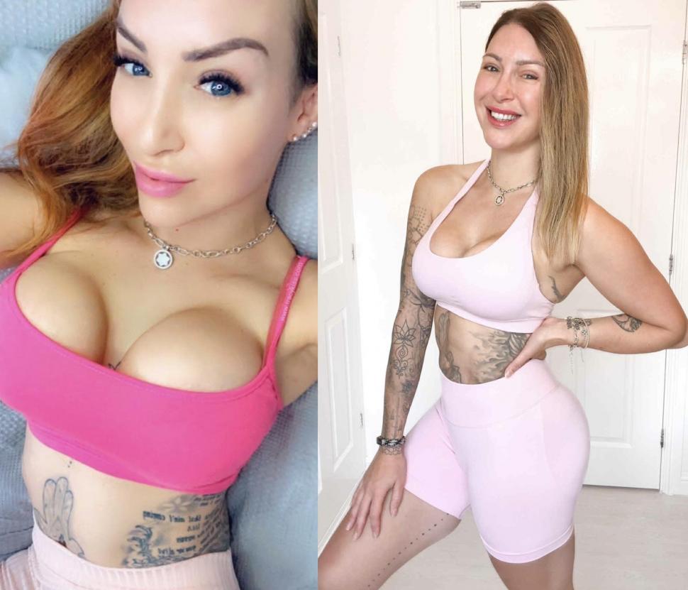 Implantul de păr, noua tendință în rândul femeilor. Rata lor de succes e complicată, dar o culturistă a ales să facă intervenţia 1029607