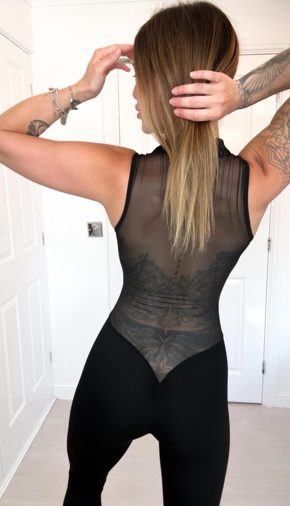 Implantul de păr, noua tendință în rândul femeilor. Rata lor de succes e complicată, dar o culturistă a ales să facă intervenţia 1029610