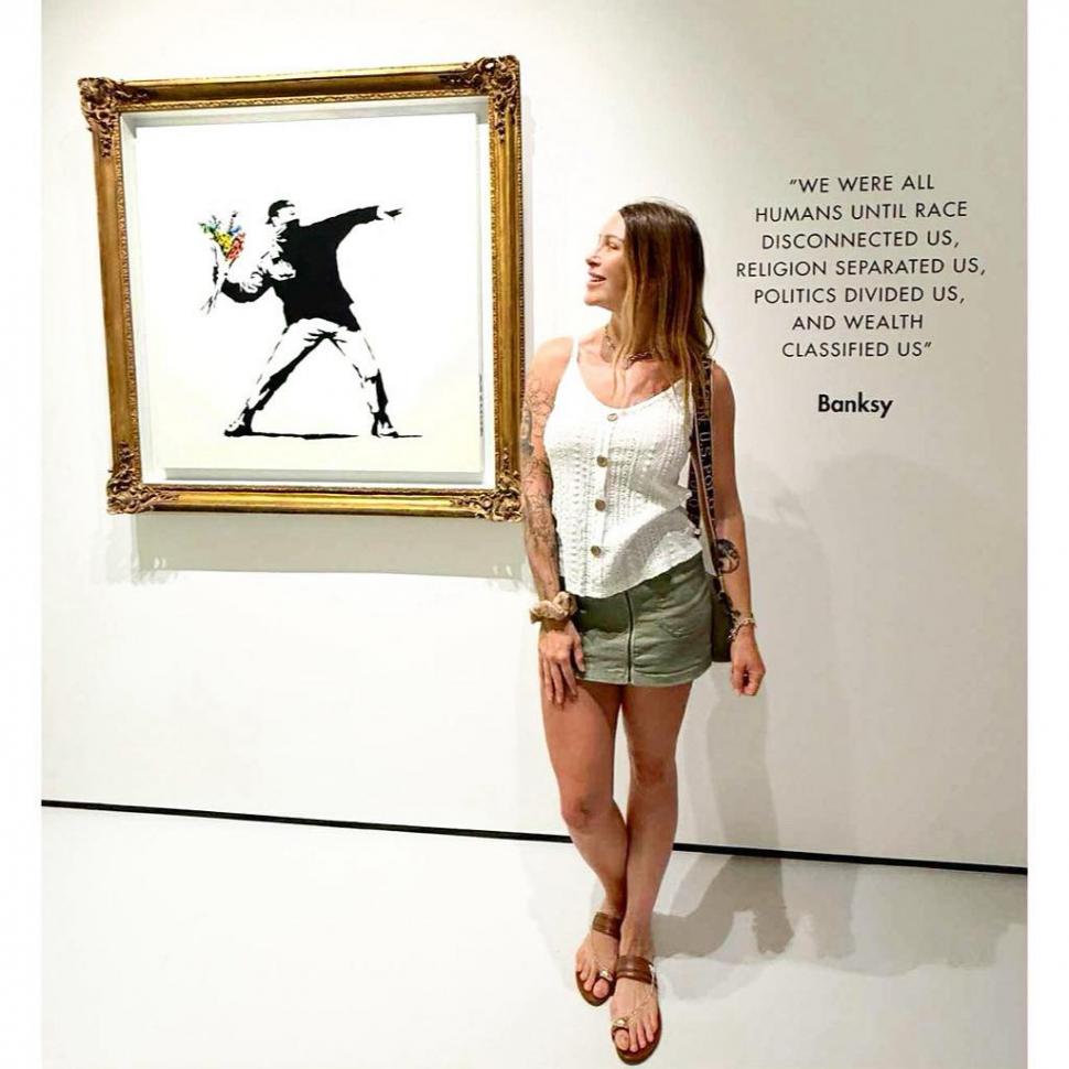 Implantul de păr, noua tendință în rândul femeilor. Rata lor de succes e complicată, dar o culturistă a ales să facă intervenţia 1029613