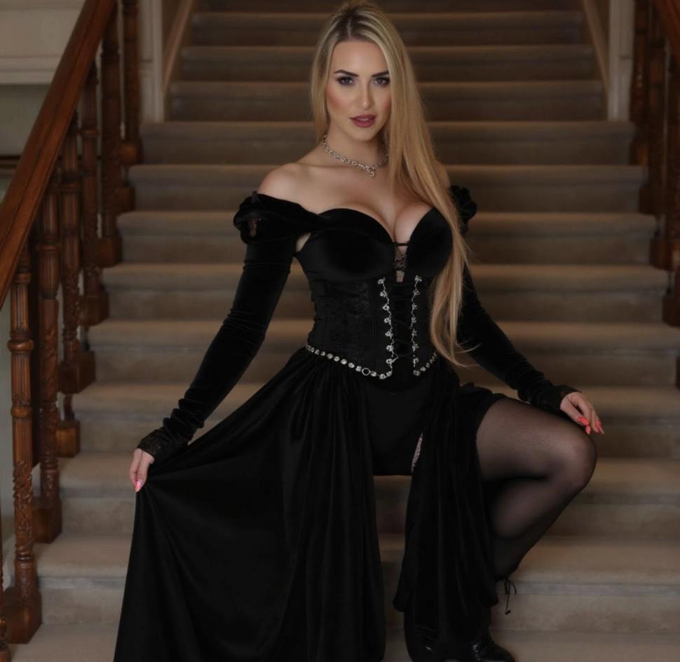 Implantul de păr, noua tendință în rândul femeilor. Rata lor de succes e complicată, dar o culturistă a ales să facă intervenţia 1029615