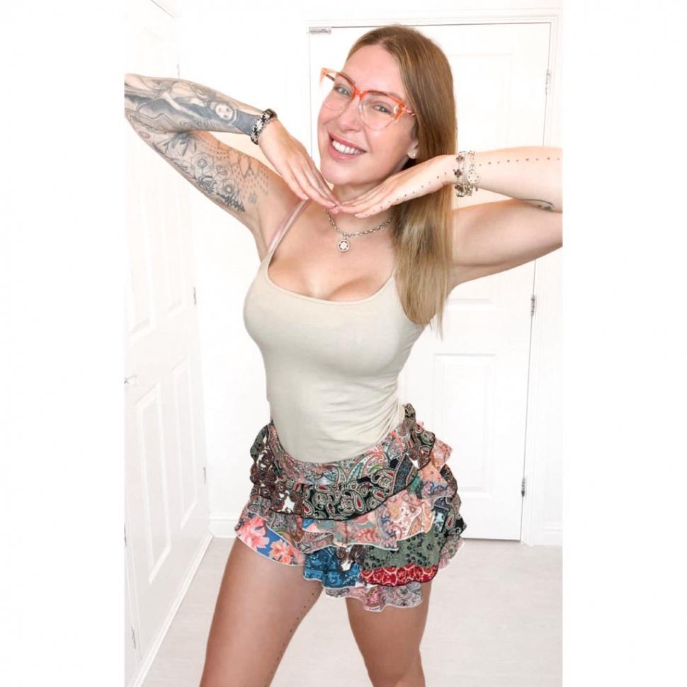 Implantul de păr, noua tendință în rândul femeilor. Rata lor de succes e complicată, dar o culturistă a ales să facă intervenţia 1029619