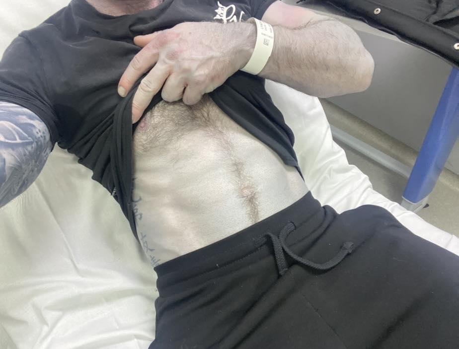 Un bărbat s-a dus la Urgențe cu pielea albastră. Panicați, medicii i-au pus masca de oxigen, apoi și-au dat seama ce avea, de fapt 1053381