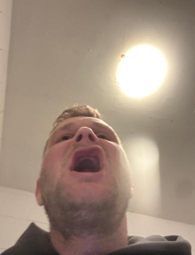 Un bărbat care a crezut că-și repară toată dantura cu 5.000 de euro în Turcia s-a întors acasă fără niciun dinte în gură 1061585