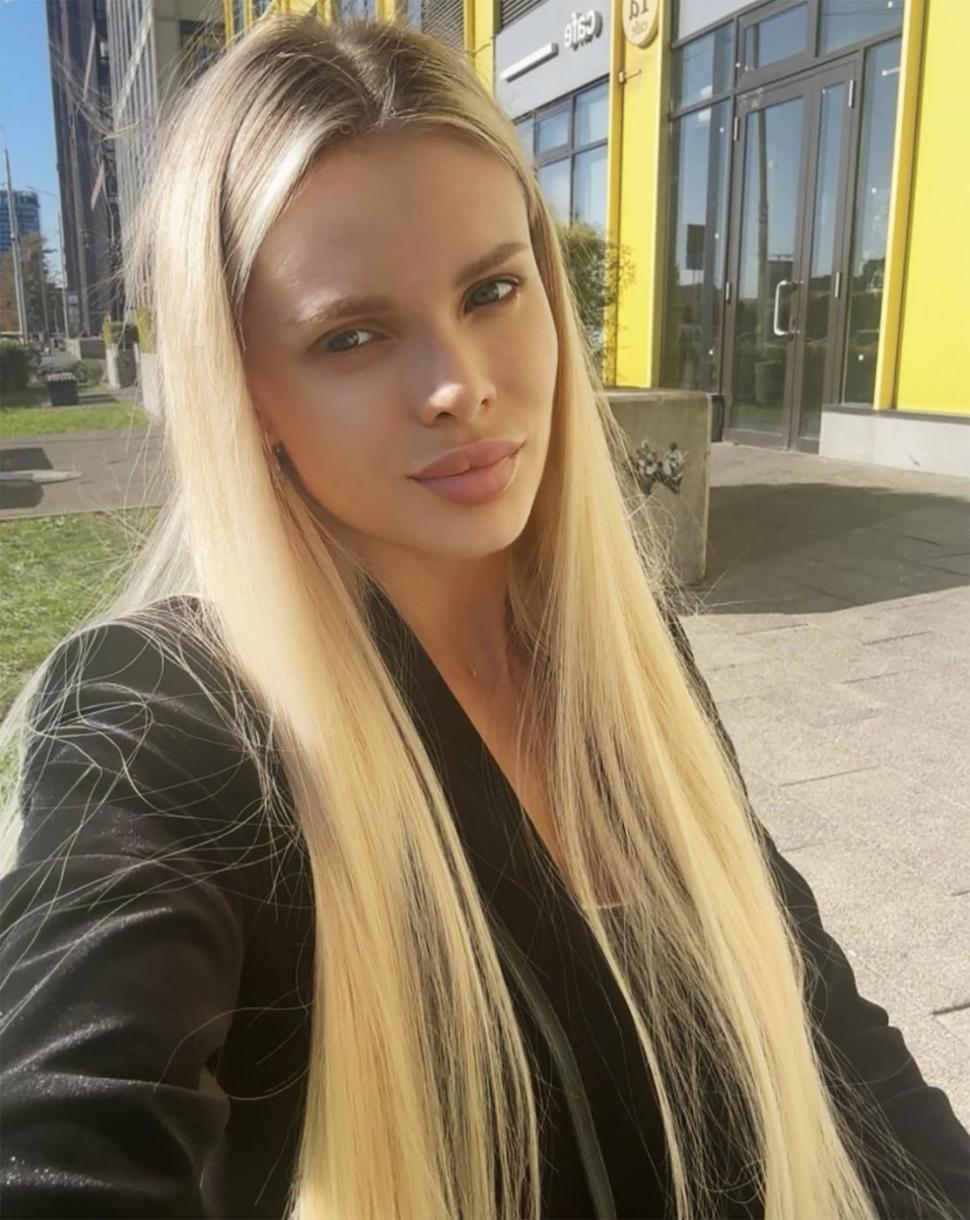 Un oligarh rus a făcut un şoc şi a murit când a aflat ce riscă pentru că și-a bătut iubita model. Ea a rămas fără jumătate din craniu 1066465