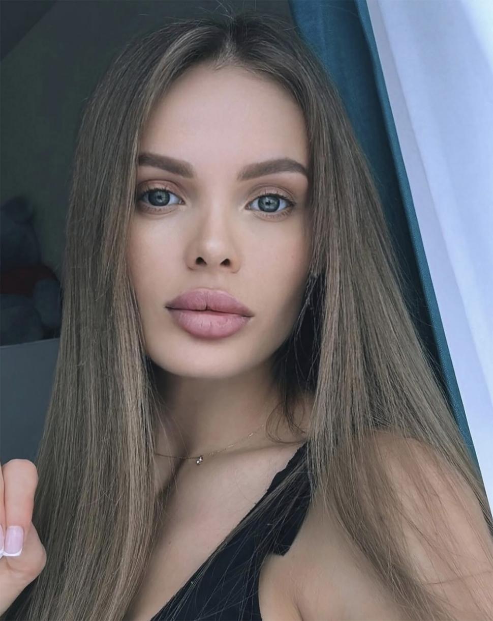 Un oligarh rus a făcut un şoc şi a murit când a aflat ce riscă pentru că și-a bătut iubita model. Ea a rămas fără jumătate din craniu 1066466