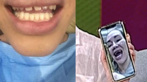 O vedetă din România și-a lipit dinții cu lipici. Nu mai putea nici să mănânce! A dat în judecată stomatologul și cere daune 