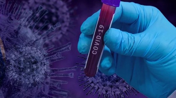 Dezvăluirile unui medic infecţionist: Acesta e numărul real al românilor infectați cu noul coronavirus!