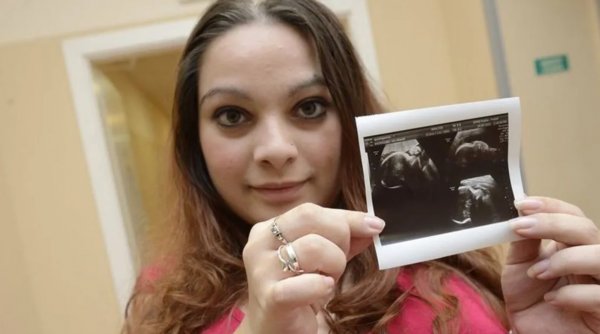 O gravidă a fost asistată la naștere de 40 de medici. Care a fost motivul