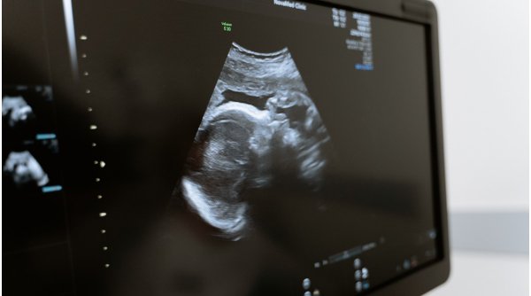 A fost lansat primul test de sarcină bazat pe salivă
