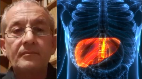 Dr. Cătălin Apostolescu explică diferenţa dintre hepatita misterioasă şi boala Wilson: 