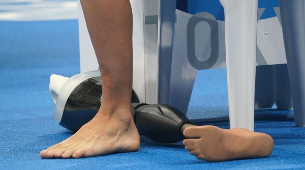 Un pacient din Spania, căutat de spitalul care i-a amputat piciorul, pentru a-l convinge să-și ia membrul acasă