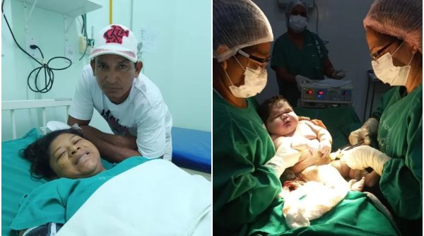 O femeie din Brazilia a dat naștere unui bebeluș gigant: 7,3 kilograme