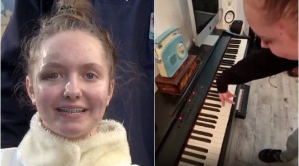 Imagini incredibile cu Alexia! | Fata cu brațele replantate a început să cânte la pian: 