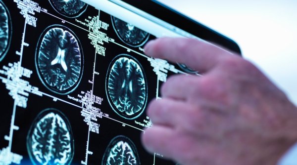 Medic neurochirurg, despre diferenţa dintre CT şi RMN | Informaţii ultile pentru rezultate cât mai precise