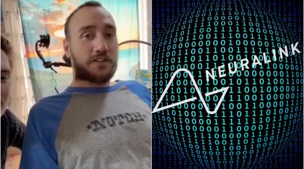 elon musk implanturi creier cinci persoane