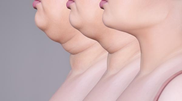 exercitiile prin care scapi fara efort de gusa sa elimini gusa este cel mai usor lucru