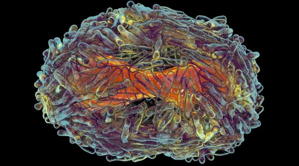 ce este virusul mortal de care s a speriat oms si cum ne putem imbolnavi