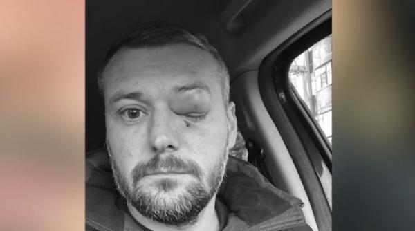 scandal urias langa o sectie de votare din slatina un barbat a fost batut crunt