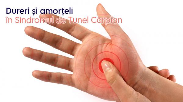 Sindromul de Tunel Carpian – când mâna devine semnalul unui stil de viață suprasolicitat 