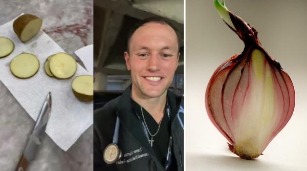 Un trend de pe TikTok, promovat de influenceri, i-a alarmat pe medici. Ce se întâmplă dacă pui felii de cartofi cruzi în șosete